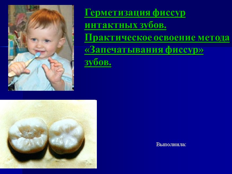 Герметизация фиссур интактных зубов.  Практическое освоение метода «Запечатывания фиссур» зубов. Выполнила: